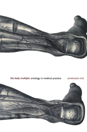 The Body Multiple: Ontology in Medical Practice