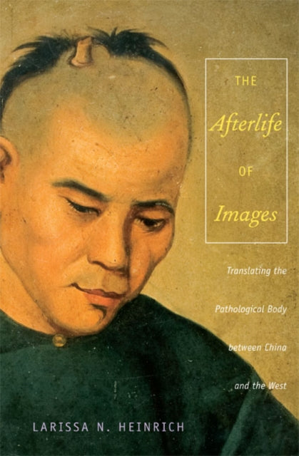 The Afterlife of Images: Translating the Pathological Body between China and the West