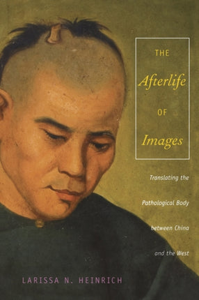 The Afterlife of Images: Translating the Pathological Body between China and the West