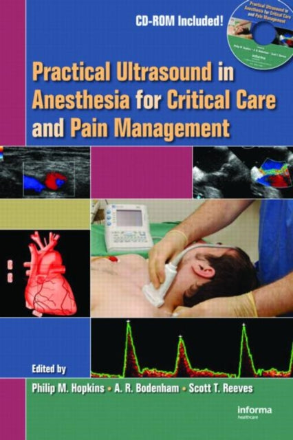 Practical Ultrasound in Anesthesia for Critical Care and Pain Management