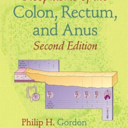 Neoplasms of the Colon, Rectum, and Anus