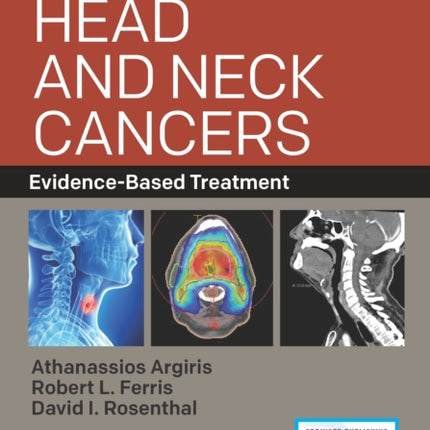 Head and Neck Cancers: Evidence-Based Treatment