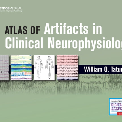 Atlas of Artifacts in Clinical Neurophysiology