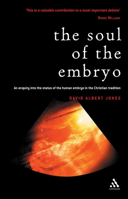 The Soul of the Embryo An Enquiry into the Status of the Human Embryo in the Christian Tradition Christianity and the Human Embryo