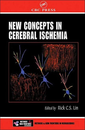 New Concepts in Cerebral Ischemia