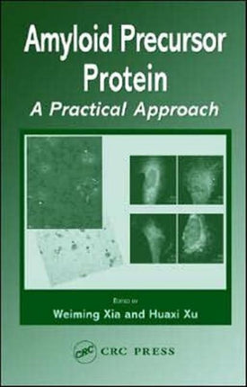 Amyloid Precursor Protein: A Practical Approach