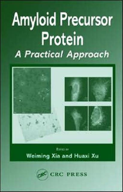 Amyloid Precursor Protein: A Practical Approach