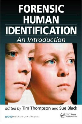 Forensic Human Identification: An Introduction