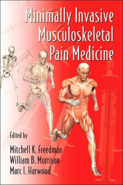 Minimally Invasive Musculoskeletal Pain Medicine