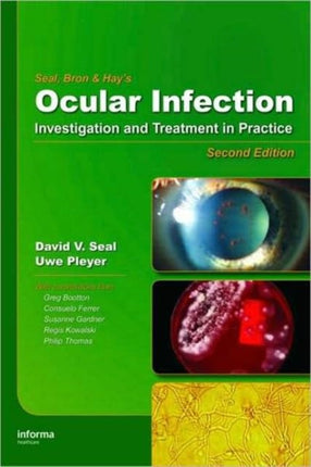 Ocular Infection: Investigation and Treatment in Practice