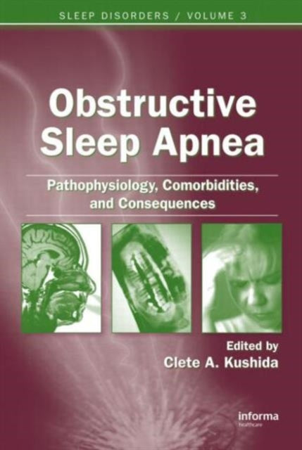 Obstructive Sleep Apnea: Pathophysiology, Comorbidities and Consequences: Pathophysiology, Comorbidities, and Consequences