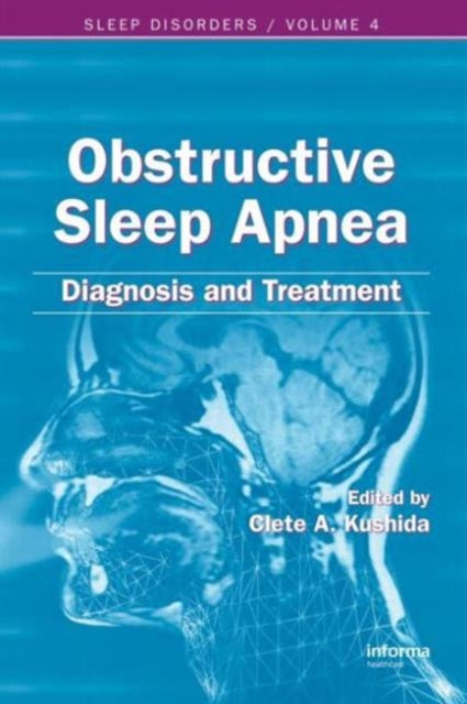 Obstructive Sleep Apnea: Diagnosis and Treatment