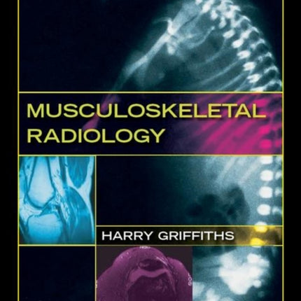 Musculoskeletal Radiology