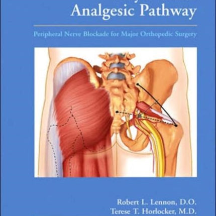 Mayo Clinic Analgesic Pathway