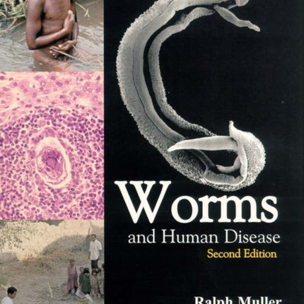 Worms and Human Disease