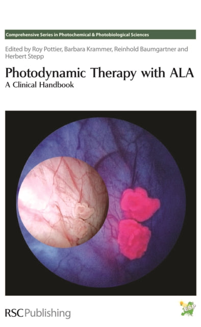 Photodynamic Therapy with ALA: A Clinical Handbook