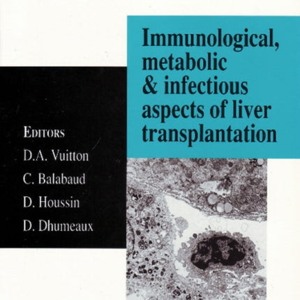 Immunological, Metabolic & Infectious Aspects of Liver Transplantation: Trends & Advances in Liver Diseases