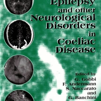 Epilepsy & Other Neurological Disorders in Coeliac Disease