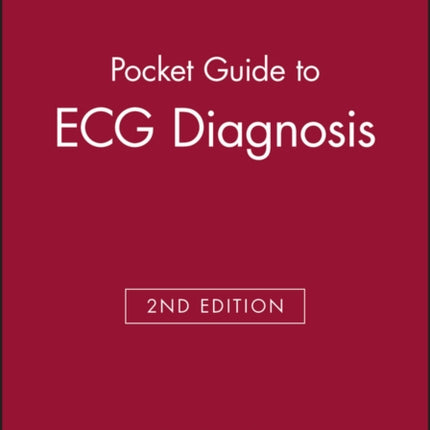 Pocket Guide to ECG Diagnosis