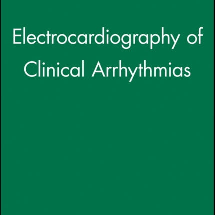 Electrocardiography of Clinical Arrhythmias