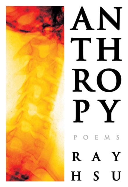 Anthropy: Poems