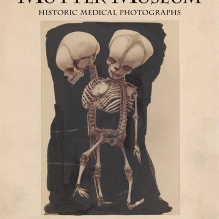 Mütter Museum Historic Medical Photographs