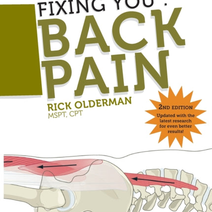 Fixing You Back Pain