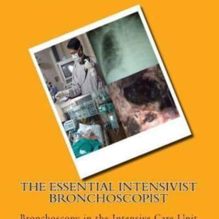 The Essential Intensivist Bronchoscopist