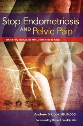 Stop Endometriosis and Pelvic Pain: What Every Woman & Her Doctor Need to Know