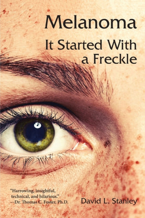 Melanoma It Started With a Freckle