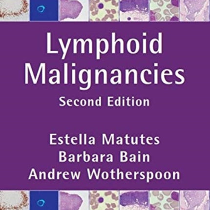 Lymphoid Malignancies: Evidence-based Handbook of Investigation and Diagnosis