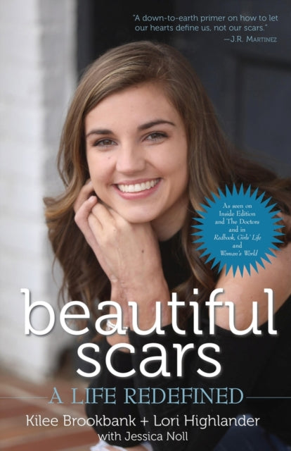 Beautiful Scars: A Life Redefined