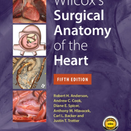 Wilcoxs Surgical Anatomy of the Heart