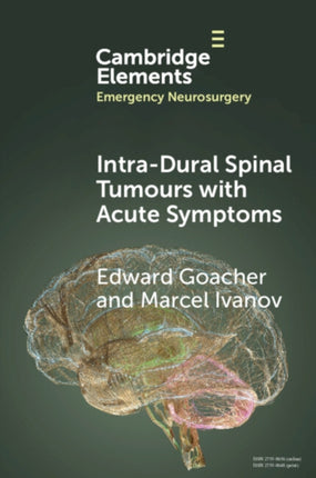 IntraDural Spinal Tumours with Acute Symptoms