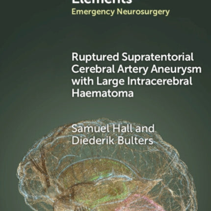 Ruptured Supratentorial Cerebral Artery Aneurysm