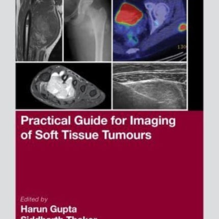Practical Guide for Imaging of Soft Tissue