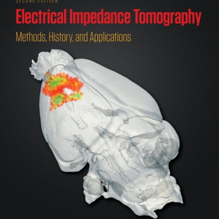 Electrical Impedance Tomography