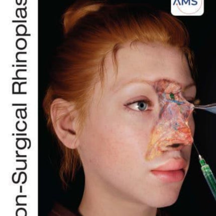 Non-Surgical Rhinoplasty