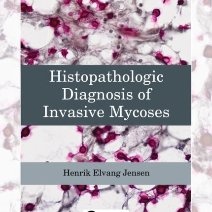 Histopathologic Diagnosis of Invasive Mycoses