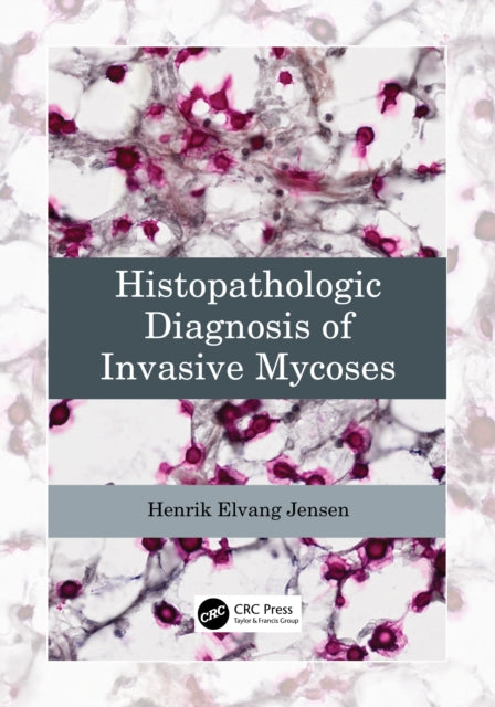 Histopathologic Diagnosis of Invasive Mycoses