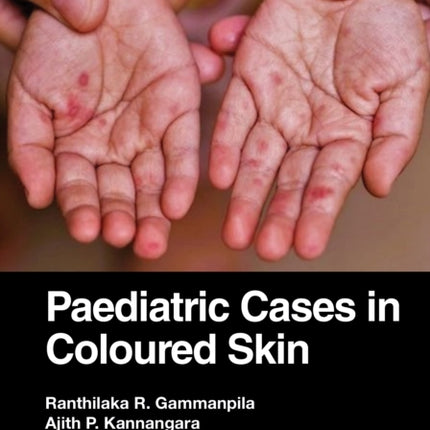 Paediatric Cases in Coloured Skin