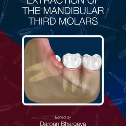 Transalveolar Extraction of the Mandibular Third Molars