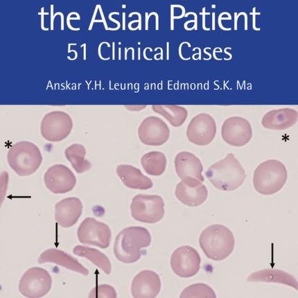 Haematology and the Asian Patient