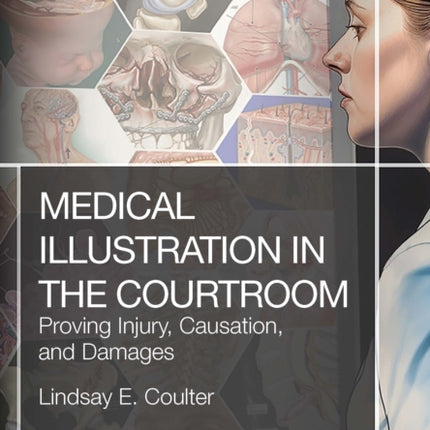 Medical Illustration in the Courtroom