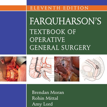 Farquharsons Textbook of Operative General Surgery