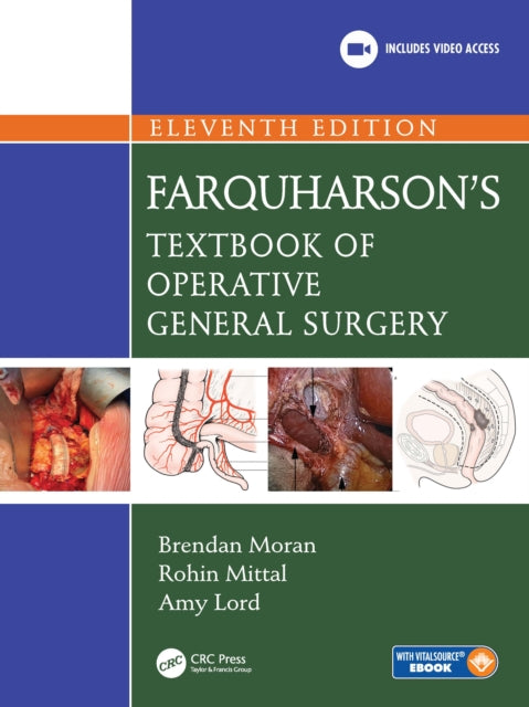 Farquharsons Textbook of Operative General Surgery