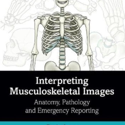 Interpreting Musculoskeletal Images: Anatomy, Pathology and Emergency Reporting