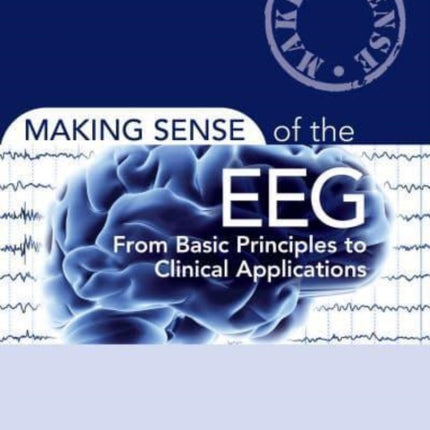 Making Sense of the EEG