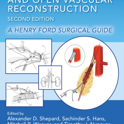 Endovascular and Open Vascular Reconstruction