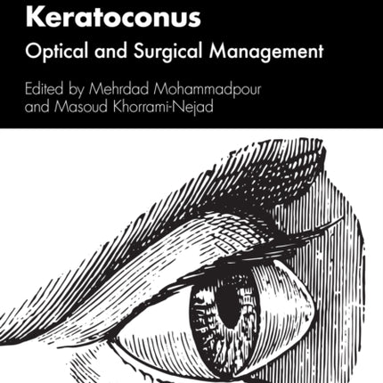 Keratoconus